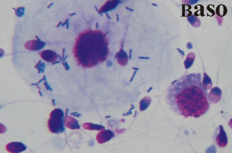 Rapid Sperm Morphological Stain